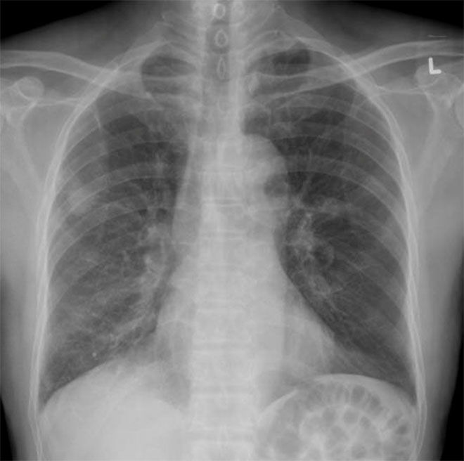 Western Toronto Thoracic Associates